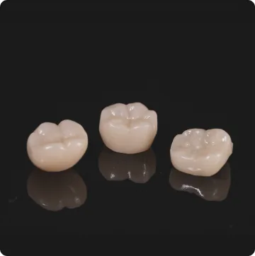 Tiga crown keramik buatan laboratorium gigi internal