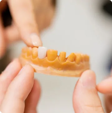 Memeriksa kecocokan restorasi pada model gigi